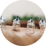 Cupping-Therapy